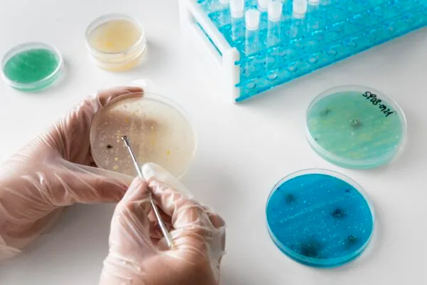 Microbiología Aplicada al Tratamiento de Aguas y Biorremediación